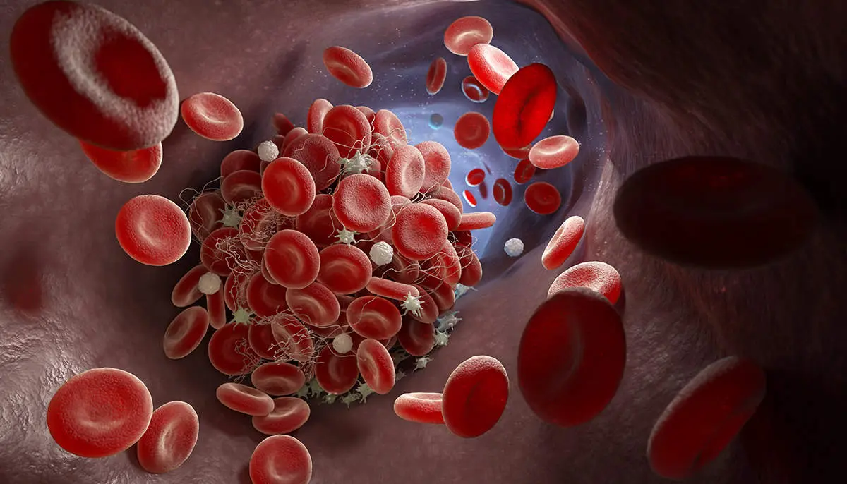 El potencial del plasma rico en plaquetas en traumatolog&iacute;a y cirug&iacute;a ortop&eacute;dica.