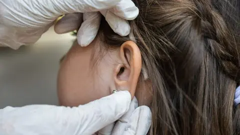 uned a coru&ntilde;a salud auditiva