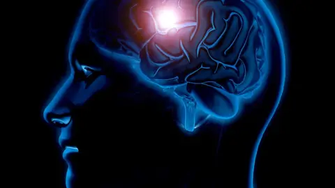 D&iacute;a mundial del Cerebro.